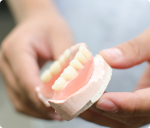 Les différents types de prothèses offertes Les différents types de prothèses offertes