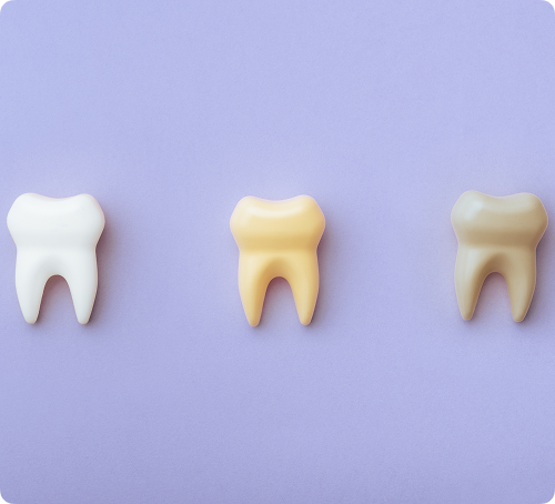 Pour quels types de taches ou jaunissement ? Pour quels types de taches ou jaunissement ?