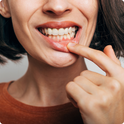 Selon la sévérité du problème, plusieurs approches sont possibles Selon la sévérité du problème, plusieurs approches sont possibles
